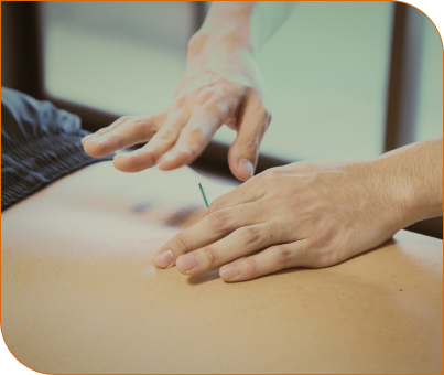 woman providing acupuncture services