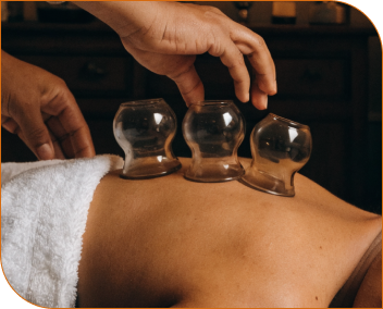 cupping