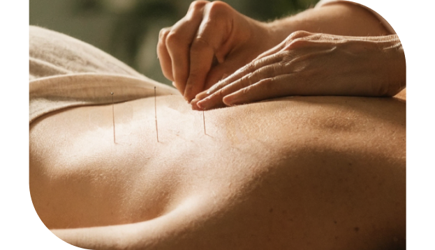 woman providing acupuncture services
