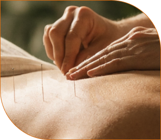 woman providing acupuncture services